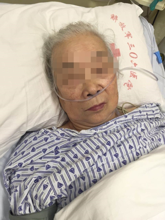 李茂发耳道取栓治疗脑梗，探索一种创新医疗技术，李茂发耳道取栓治疗脑梗，创新医疗技术的探索与实践